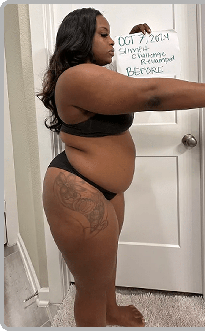 Brandie W. before transformation