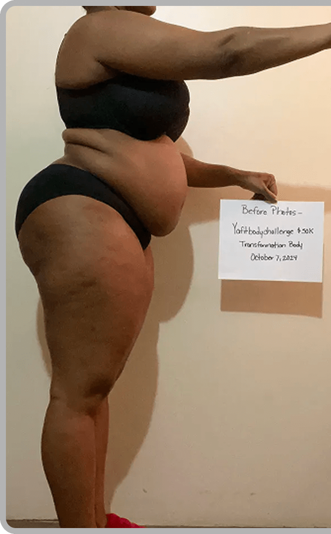 Kalia H. before transformation