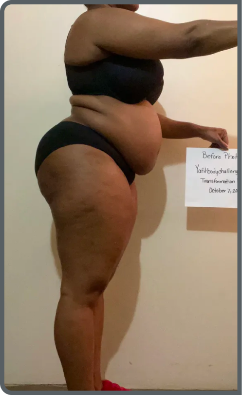 Kalia H. before transformation
